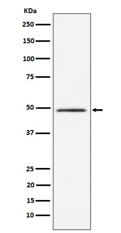Western Blot: CLP1/HEAB Antibody (SR1834) [NBP3-22477] - Western blot analysis using NBP3-22477 in HeLa cell lysate.