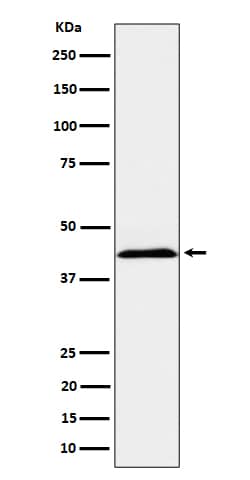 Western Blot: NKp44/NCR2 Antibody (SR1752) [NBP3-22479] - Western blot analysis using NBP3-22479 in K562 cell lysate.