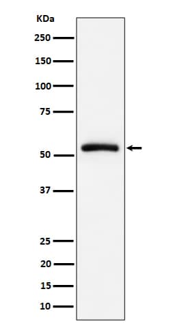 Western Blot: CAP1 Antibody (SR1982) [NBP3-22480] - Western blot analysis using NBP3-22480 in Raji cell lysate.