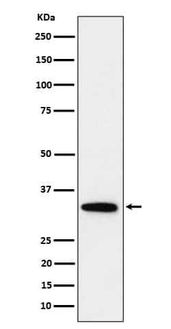 Western Blot: PPP6C Antibody (SR1537) [NBP3-22483] - Western blot analysis using NBP3-22483 in HeLa cell lysate.