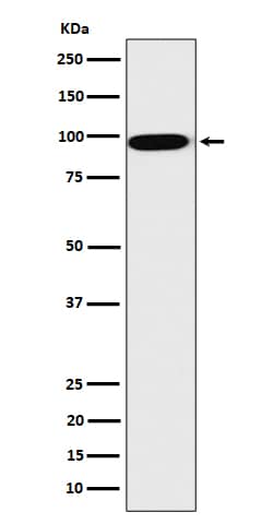 Western Blot CLPTM1 Antibody (SR2274)