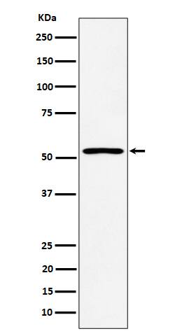 Western Blot: SAMM50 Antibody (SR1928) [NBP3-22489] - Western blot analysis using NBP3-22489 in HepG2 cell lysate.