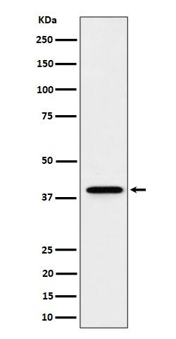 Western Blot: WDR68 Antibody (SR1650) [NBP3-22492] - Western blot analysis using NBP3-22492 in HeLa cell lysate.