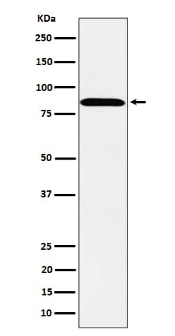 Western Blot: PPM1E Antibody (SR2281) [NBP3-22493] - Western blot analysis using NBP3-22493 in SH-SY5Y cell lysate.