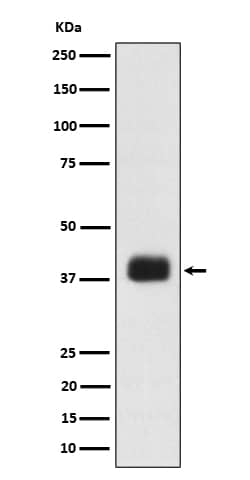 Western Blot: SRp55 Antibody (SR1629) [NBP3-22494] - Western blot analysis using NBP3-22494 in K562 cell lysate.