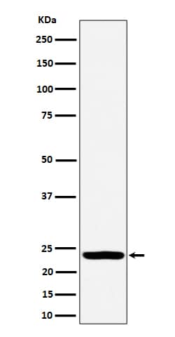 Western Blot: DTYMK Antibody (SR1364) [NBP3-22500] - Western blot analysis using NBP3-22500 in HeLa cell lysate.