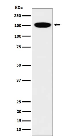 Western Blot: CNAP1 Antibody (SR1189) [NBP3-22503] - Western blot analysis using NBP3-22503 in HeLa cell lysate.