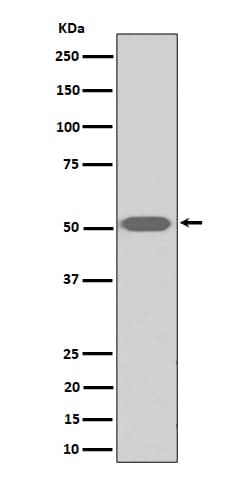 Western Blot: Thromboxane A2 R/TBXA2R Antibody (SR1893) [NBP3-22509] - Western blot analysis using NBP3-22509 in human platelet cell lysate.