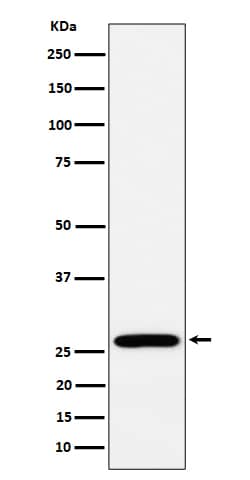 Western Blot: RPL13 Antibody (SR1422) [NBP3-22510] - Western blot analysis using NBP3-22510 in MCF7 cell lysate.