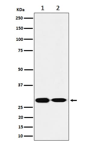 Western Blot: SNAP29 Antibody (SR1445) [NBP3-22512] - Western blot analysis using NBP3-22512 in (1) HeLa cell lysate; (2) Mouse brain lysate.