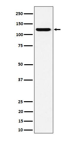 Western Blot: PKN2 Antibody (SR1159) [NBP3-22513] - Western blot analysis using NBP3-22513 in HeLa cell lysate.