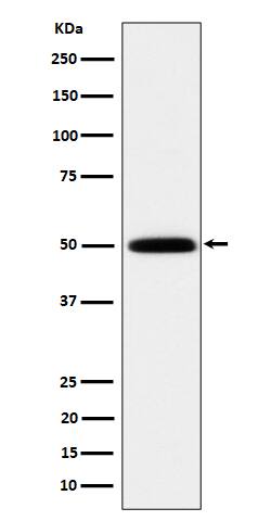 Western Blot: HARS Antibody (SR1884) [NBP3-22515] - Western blot analysis using NBP3-22515 in 293T cell lysate.