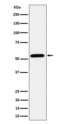 Western Blot ENPP-5 Antibody (SR1988)