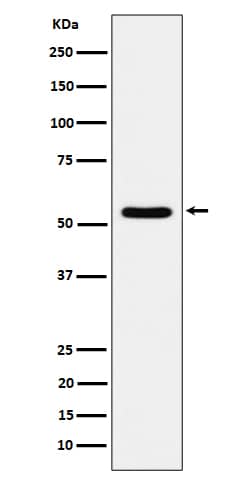 Western Blot: TOE1 Antibody (SR2067) [NBP3-22517] - Western blot analysis using NBP3-22517 in 293T cell lysate.
