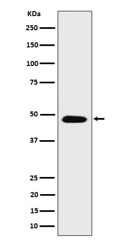 Western Blot: COPS4 Antibody (SR1873) [NBP3-22524] - Western blot analysis using NBP3-22524 in SH-SY5Y cell lysate.