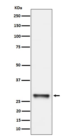 Western Blot: PNMT Antibody (SR1514) [NBP3-22526] - Western blot analysis using NBP3-22526 in K562 cell lysate.