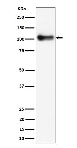 Western Blot: Thrombomodulin/BDCA-3 Antibody (SR1034) [NBP3-22533] - Western blot analysis using NBP3-22533 in mouse lung cell lysate.