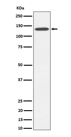 Western Blot: Cadherin-4/R-Cadherin Antibody (SR1130) [NBP3-22545] - Western blot analysis using NBP3-22545 in HepG2 cell lysate.