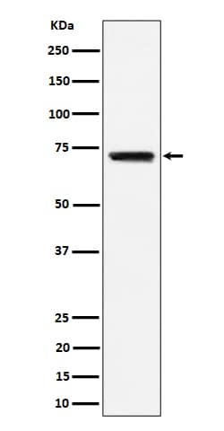 Western Blot: BLNK Antibody (SR2143) [NBP3-22546] - Western blot analysis using NBP3-22546 in Raji cell lysate.