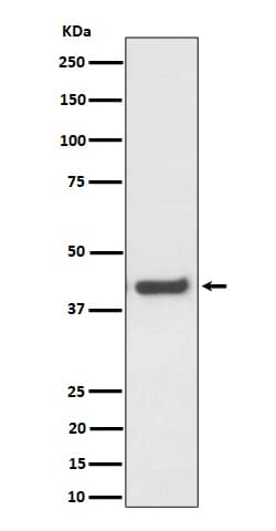 Western Blot: MVK Antibody (SR1713) [NBP3-22554] - Western blot analysis using NBP3-22554 in HepG2 cell lysate.