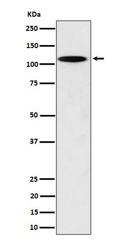 Western Blot: N4BP1 Antibody (SR1060) [NBP3-22555] - Western blot analysis using NBP3-22555 in PC12 cell lysate.