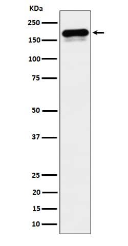 Western Blot: CLIP170 Antibody (SR1120) [NBP3-22556] - Western blot analysis using NBP3-22556 in HeLa cell lysate.