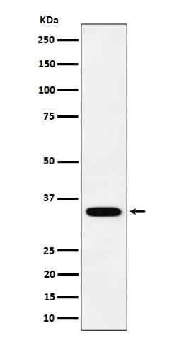 Western Blot: Phosphopantothenate-cysteine ligase Antibody (SR1567) [NBP3-22559] - Western blot analysis using NBP3-22559 in SH-SY5Y cell lysate.