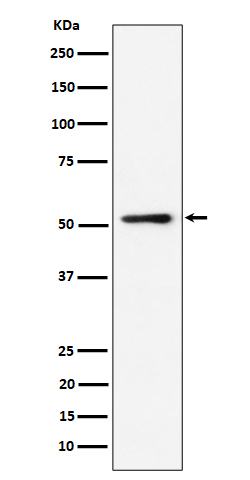 Western Blot: NUP50 Antibody (SR1991) [NBP3-22560] - Western blot analysis using NBP3-22560 in HeLa cell lysate.