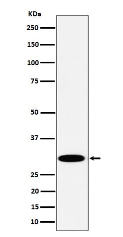 Western Blot: TPMT Antibody (SR1518) [NBP3-22563] - Western blot analysis using NBP3-22563 in Jurkat cell lysate.