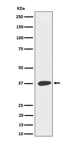 Western Blot: MAS1L Antibody (SR1619) [NBP3-22564] - Western blot analysis using NBP3-22564 in 293T cell lysate.
