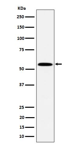 Western Blot: PNK Antibody (SR2020) [NBP3-22567] - Western blot analysis using NBP3-22567 in Jurkat cell lysate.