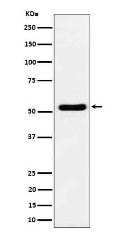 Western Blot: GPRC5B Antibody (SR1918) [NBP3-22573] - Western blot analysis using NBP3-22573 in Jurkat cell lysate.