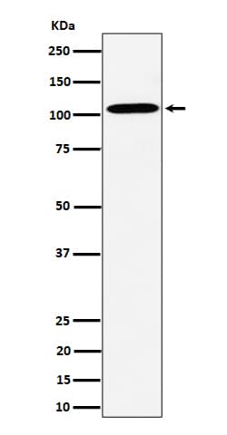 Western Blot: VDP p115 Antibody (SR1047) [NBP3-22575] - Western blot analysis using NBP3-22575 in HepG2 cell lysate.