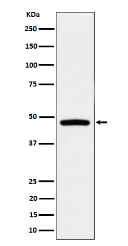 Western Blot: PREB Antibody (SR1780) [NBP3-22579] - Western blot analysis using NBP3-22579 in Raji cell lysate.