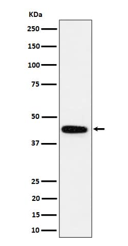 Western Blot: GALT Antibody (SR1733) [NBP3-22582] - Western blot analysis using NBP3-22582 in K562 cell lysate.