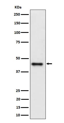 Western Blot: DAZAP1 Antibody (SR1732) [NBP3-22585] - Western blot analysis using NBP3-22585 in Jurkat cell lysate.