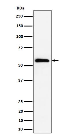 Western Blot: PNK Antibody (SR2021) [NBP3-22588] - Western blot analysis using NBP3-22588 in HeLa cell lysate.
