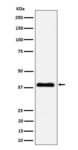 Western Blot: NSDHL Antibody (SR1643) [NBP3-22589] - Western blot analysis using NBP3-22589 in A431 cell lysate.