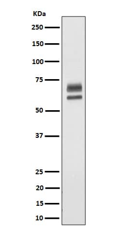 Western Blot: PPP2R5D Antibody (SR2044) [NBP3-22590] - Western blot analysis using NBP3-22590 in HeLa cell lysate.