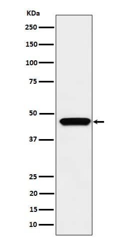 Western Blot: MAPKAP Kinase 3 Antibody (SR1737) [NBP3-22593] - Western blot analysis using NBP3-22593 in Jurkat cell lysate.