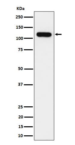 Western Blot: NOLC1 Antibody (SR1061) [NBP3-22598] - Western blot analysis using NBP3-22598 in HeLa cell lysate.