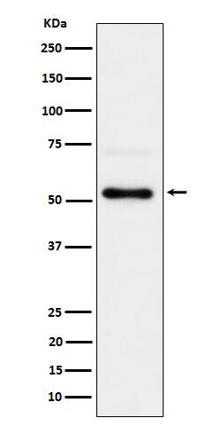 Western Blot: Chk1 [p Ser 280] Antibody (SR1952) [NBP3-22609] - Western blot analysis using NBP3-22609 in 293T treated with Calyculin A cell lysate.