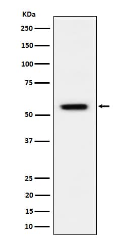 Western Blot: Vimentin [p Ser 39] Antibody (SR1953) [NBP3-22613] - Western blot analysis using NBP3-22613 in HeLa treated with Calyculin A cell lysate.