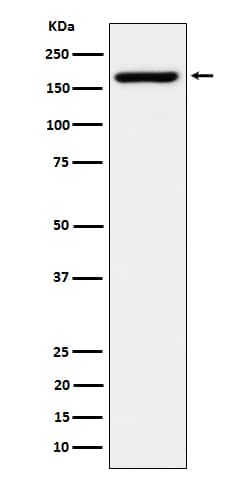 Western Blot: EIF3A Antibody (SR1221) [NBP3-22618] - Western blot analysis using NBP3-22618 in Jurkat cell lysate.