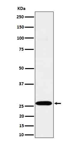 Western Blot: Complement Component C1qA Antibody (SR1502) [NBP3-22621] - Western blot analysis using NBP3-22621 in C6 cell lysate.