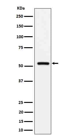 Western Blot: Fetuin B Antibody (SR1975) [NBP3-22629] - Western blot analysis using NBP3-22629 in human serum cell lysate.