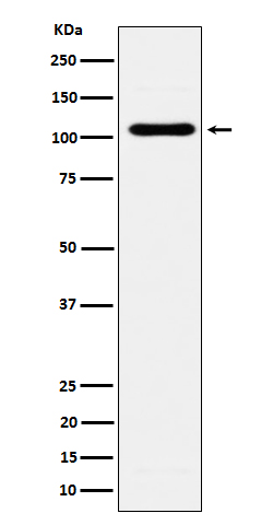 Western Blot: EXOC2 Antibody (SR1032) [NBP3-22632] - Western blot analysis using NBP3-22632 in BxPC-3 cell lysate.
