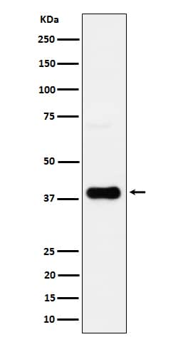 Western Blot: CXCR6 Antibody (SR1646) [NBP3-22635] - Western blot analysis using NBP3-22635 in JAR cell lysate.