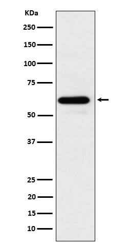 Western Blot: CDC73/HRPT2 Antibody (SR2070) [NBP3-22637] - Western blot analysis using NBP3-22637 in 293T cell lysate.