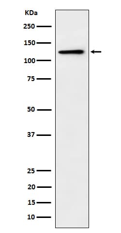 Western Blot: Palladin Antibody (SR1122) [NBP3-22639] - Western blot analysis using NBP3-22639 in PC3 cell lysate.